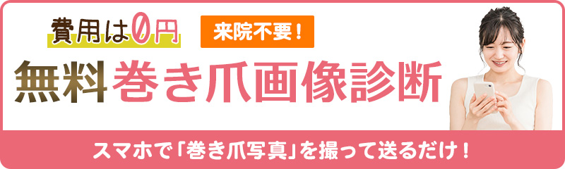 無料巻き爪画像診断