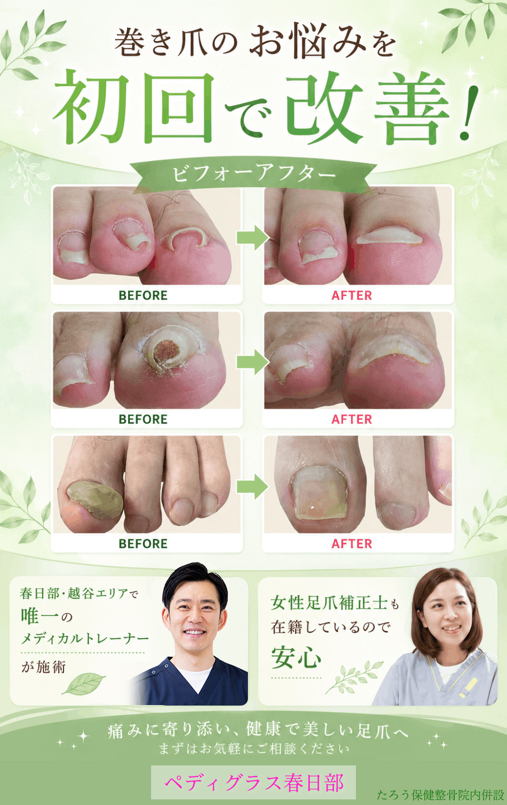 春日部たろう保健整骨院の巻きつめ画像