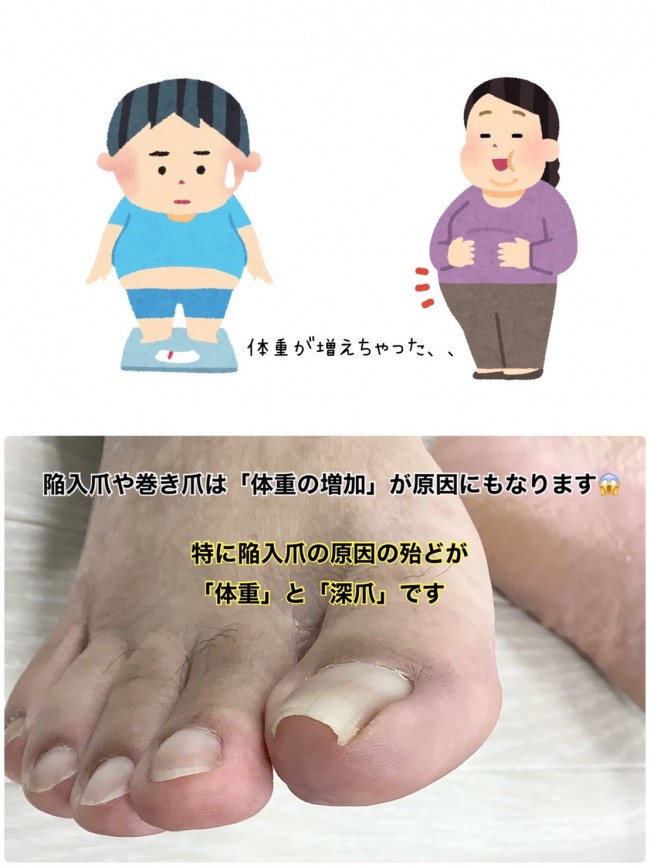 巻きづめと体重の関係