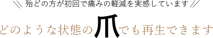巻き爪バナー